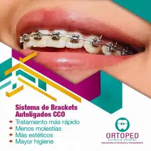 Ortodoncista en Lindavista