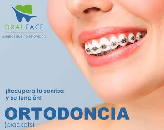 Ortodoncista en Tlalnepantla