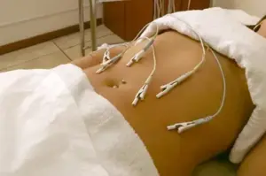 Clínica de Nutrición en Col. del Valle. Resultados efectivos. 6 electrolipolisis abdomen 1920w