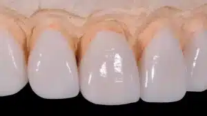 Dentista san luis potosi