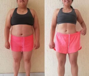 Bariatra en Piedras Negras - Nutrióloga Clínica y Deportiva. Agenda aquí 6 paciente 1 collage