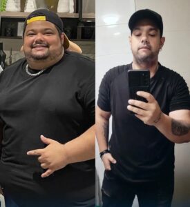 Bariatra en Piedras Negras - Nutrióloga Clínica y Deportiva. Agenda aquí 8 paciente 2 collage