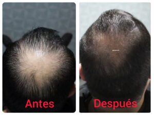 Médico Estético en Piedras Negras. Resultados efectivos 8 WhatsApp Image 2025 10 15 at 12.36.26 PM